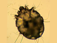 scabies mites look