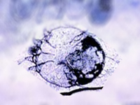 scabies mites